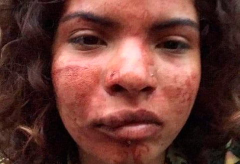 Nicol Valentina Jiménez, víctima de racismo en Portugal