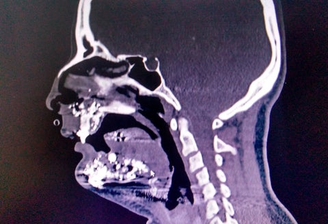 Los daños que sufrió la mujer