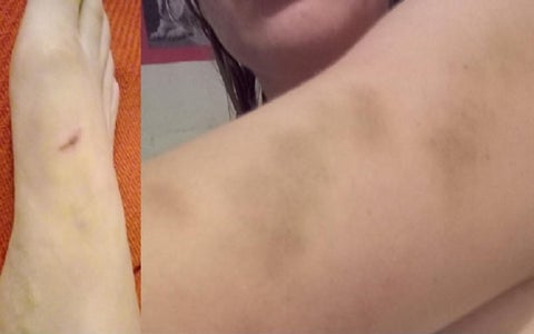 Periodista agredida por policías de Soacha