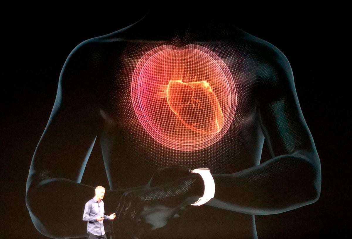 Hacer electrocardiogramas, uno de los servicios del Apple Watch