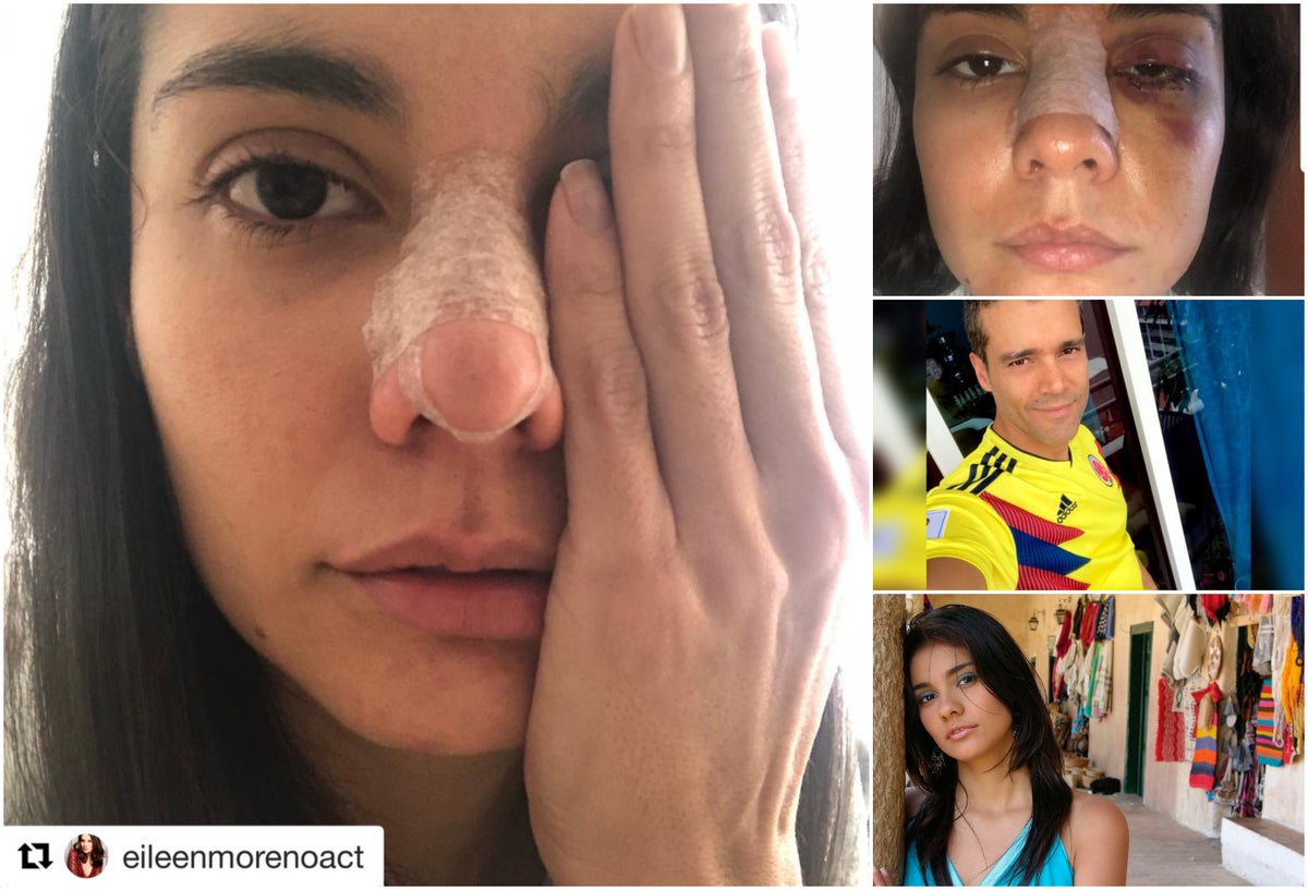 Eileen Moreno y las secuelas de la golpiza propinada por Alejandro García