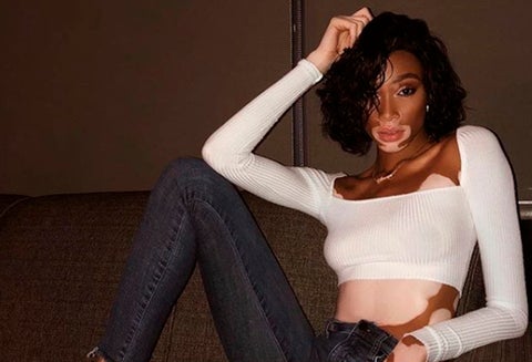 Winnie Harlow