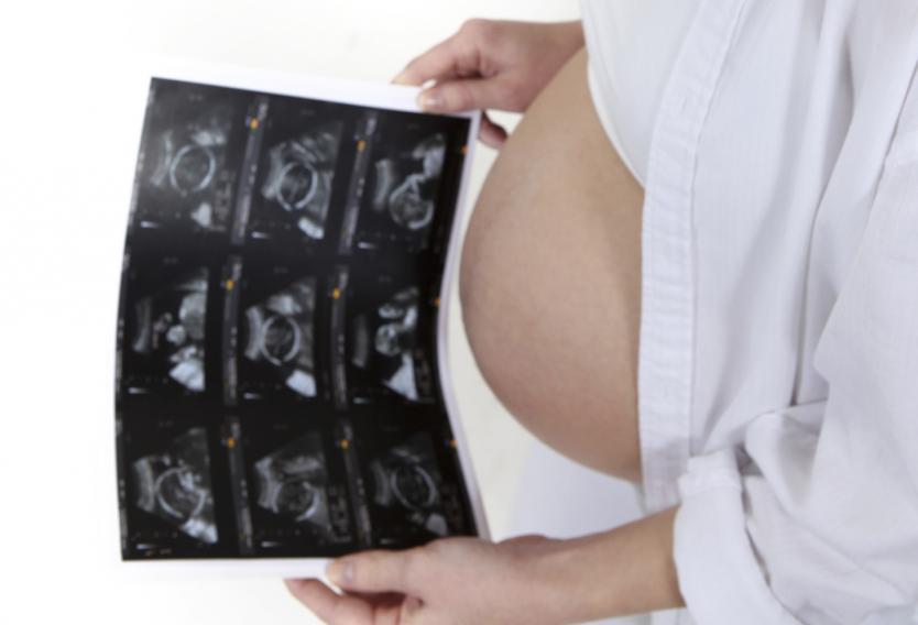 Aborto en Colombia