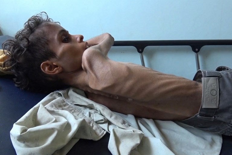 Niños hambre Yemen