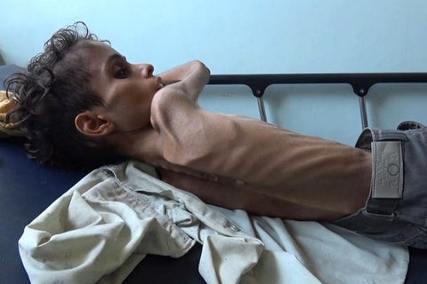 Niños hambre Yemen