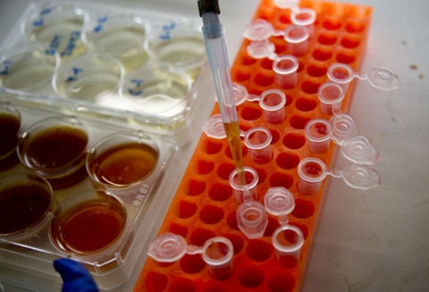 En Colombia las bacterias resistentes a los antibióticos ha incrementado.