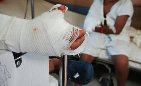 Primer quemado en Caldas