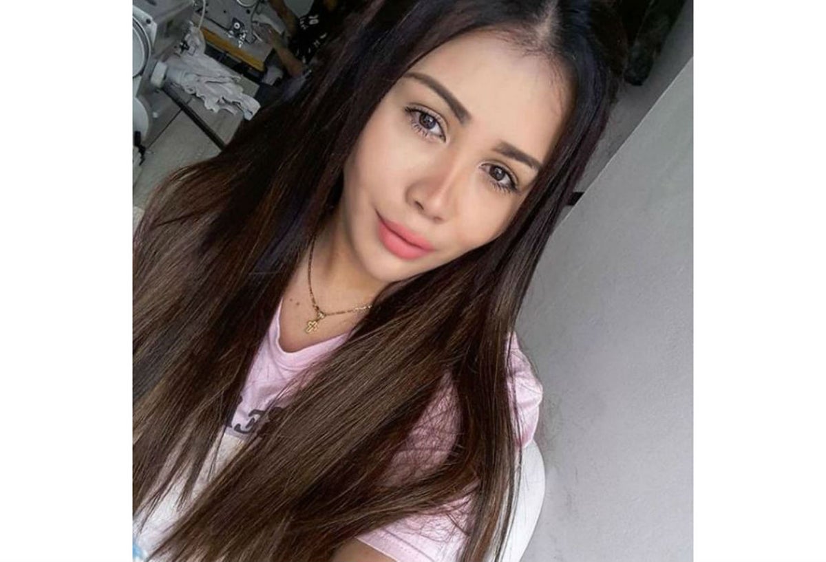 Yina Calderón se operó la cara y los labios