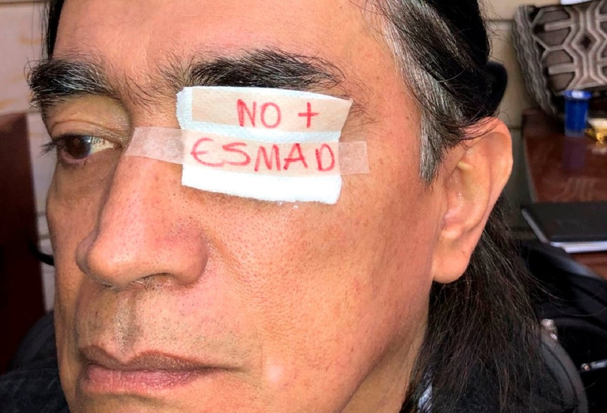 El senador Gustavo Bolívar repudió el ataque de la Fuerza Pública hacía el estudiante Esteban Mosquera de la Unicauca.