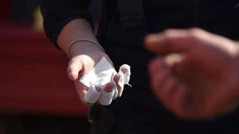 Quemado con Pólvora