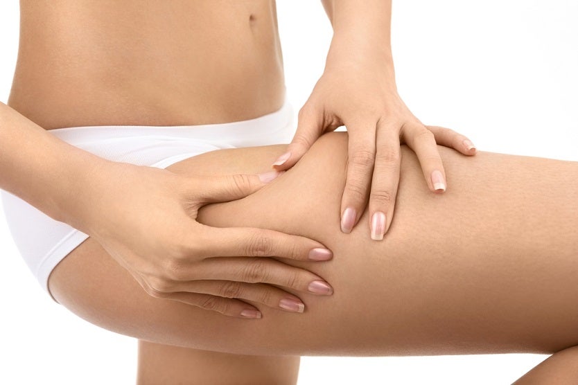 Celulitis