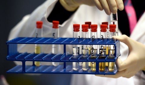 Cinco deportes están involucrados en un nuevo escándalo por sustancias prohibidas.