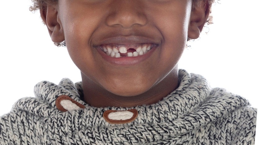 Dientes de leche