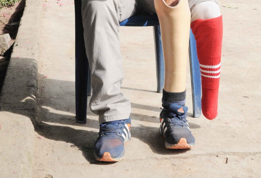 Víctima de Minas antipersonales