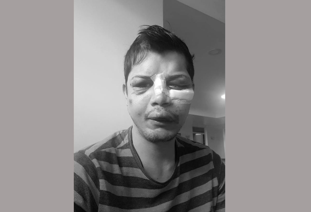 El ciudadano Arturo Montt tras denunciar agresión