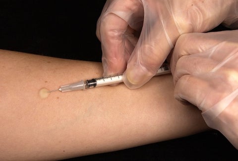 virus de VIH