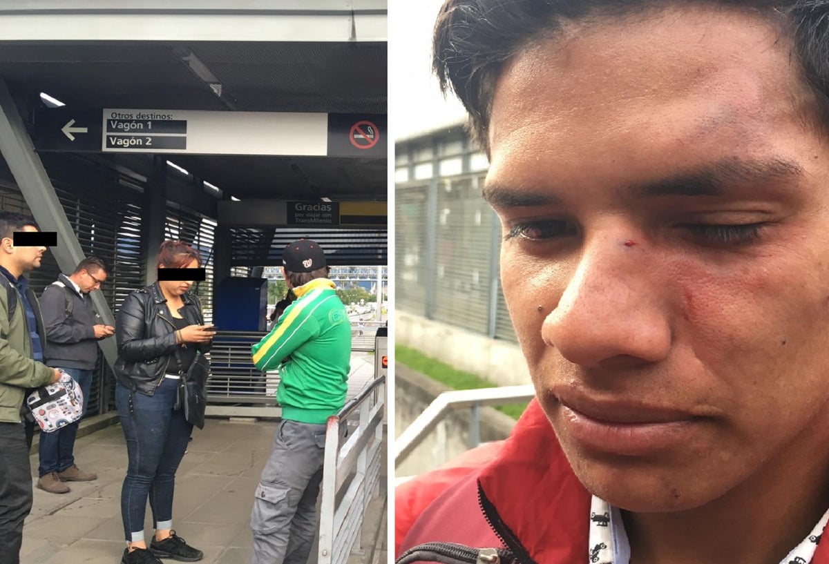 Agredido en Transmilenio