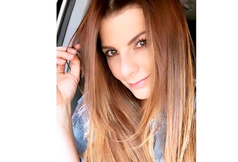 La presentadora contó cómo ha lidiado con el defecto que tiene en su boca.