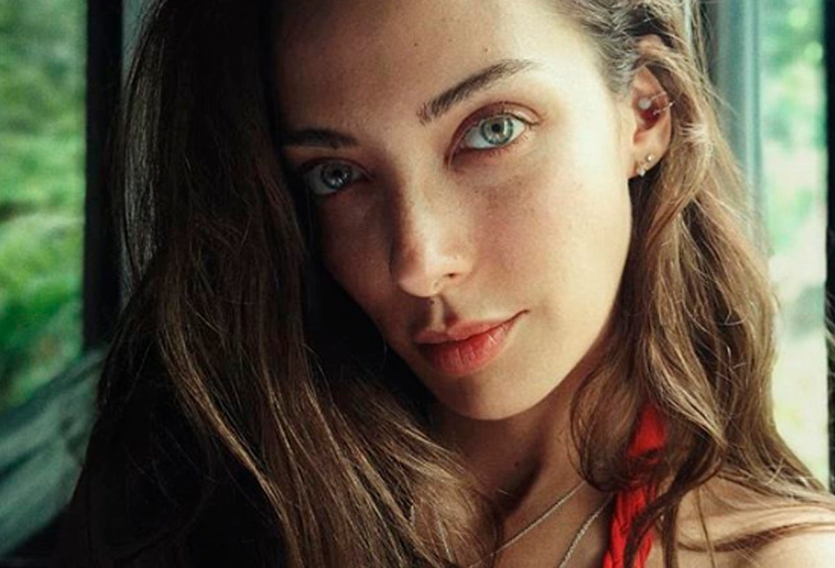 La modelo confesó que tuvo que operarse para lidiar con este problema.