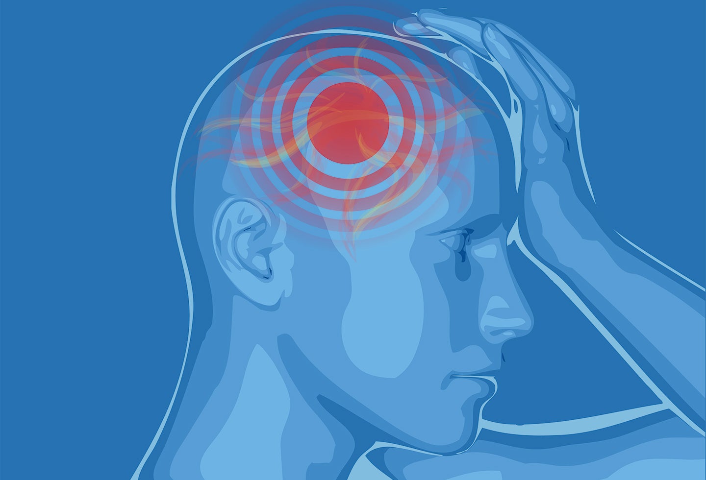Foto de referencia sobre la migraña