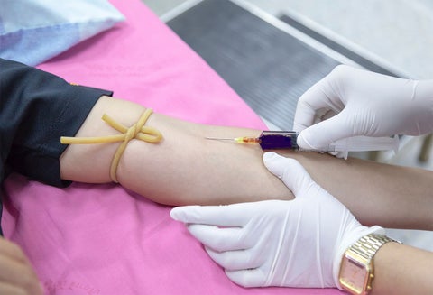 Toma de muestra de sangre