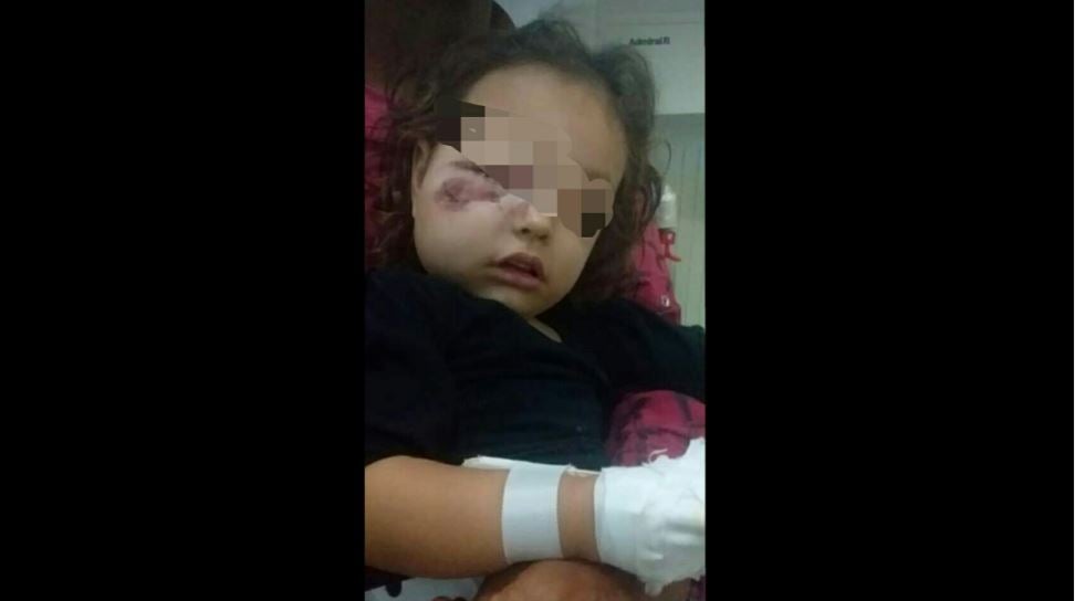 Fotos de la niña agredida han dejado constancia de la violencia con la que fue golpeada