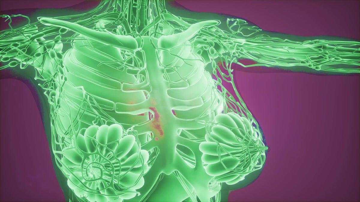Tecnología detectaría cáncer de seno