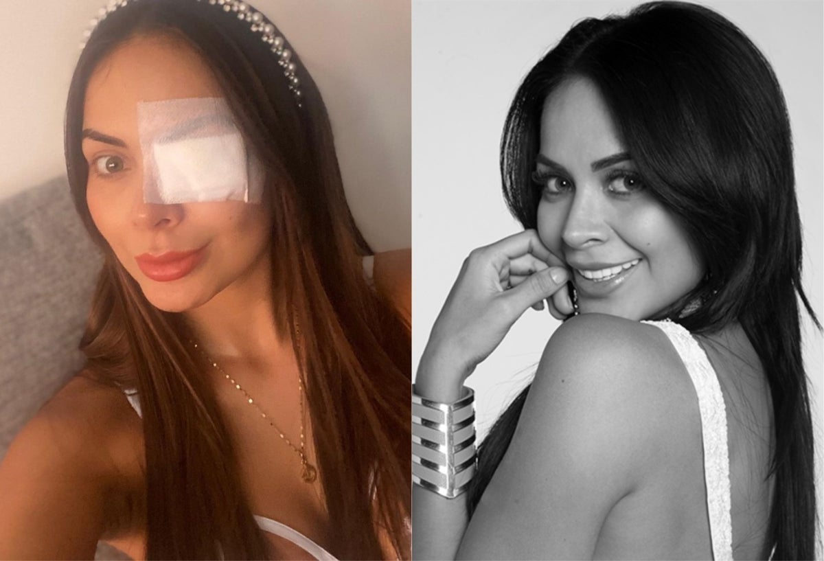 Laura González Díaz y el problema con su ojo