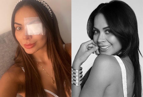 Laura González Díaz y el problema con su ojo