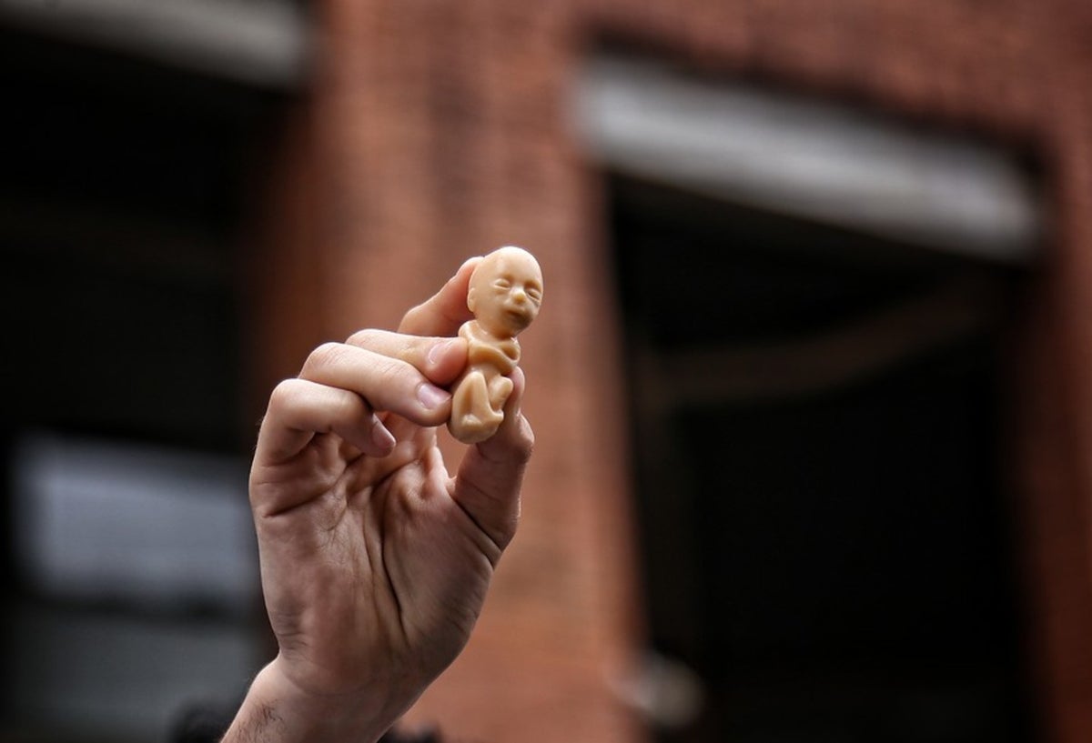 Aborto en Colombia
