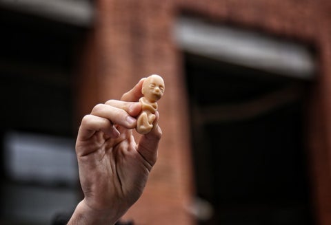 Aborto en Colombia
