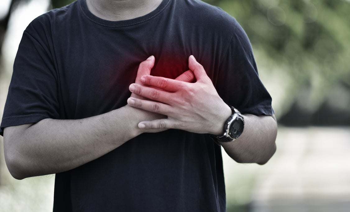 Infarto