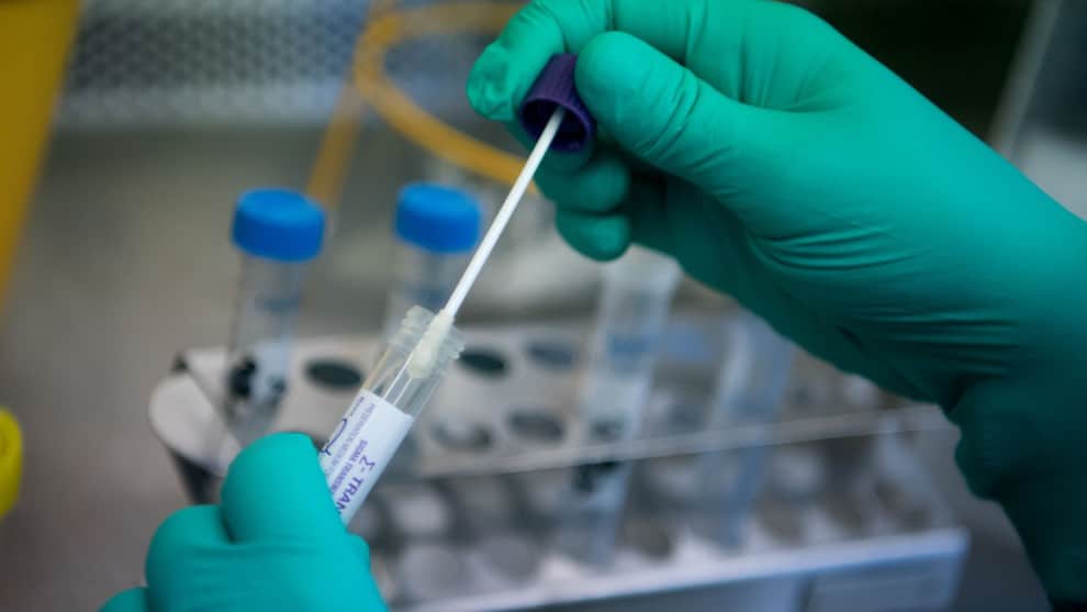 Estos casos son analizados en pruebas de laboratorio para determinar si son positivos o negativos con el virus