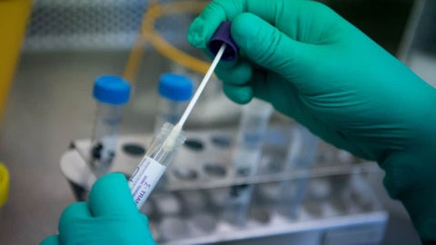 Estos casos son analizados en pruebas de laboratorio para determinar si son positivos o negativos con el virus