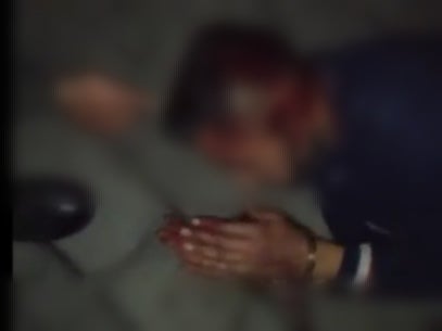 Hombre víctima de abuso policial den Bogotá