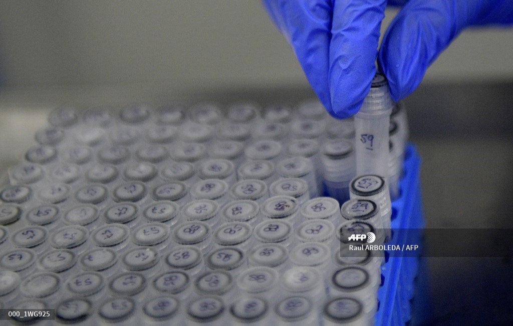 Coronavirus - Tratamiento con plasma