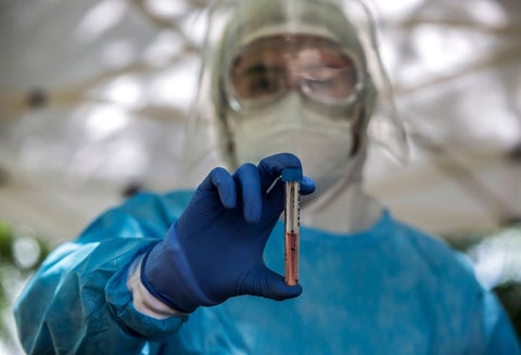 Pruebas de coronavirus