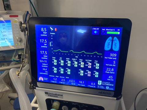 ventiladores mecánicos