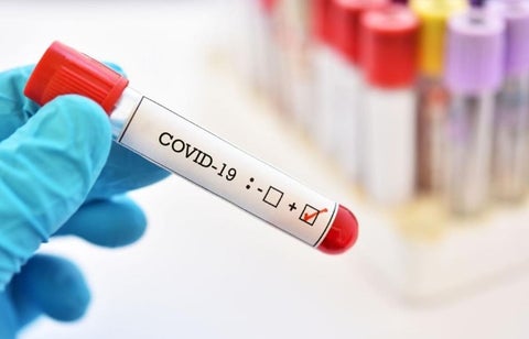 Prueba de coronavirus
