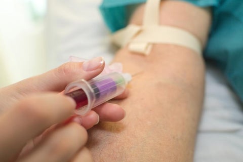 Toma de muestras de sangre (Imagen referencial).