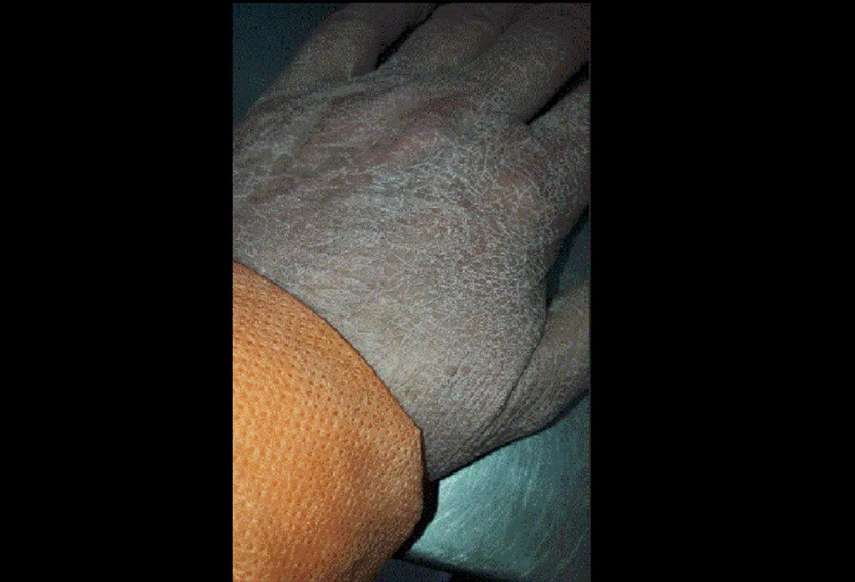 Mano de la médica Monica Paporello tras horas de trabajo