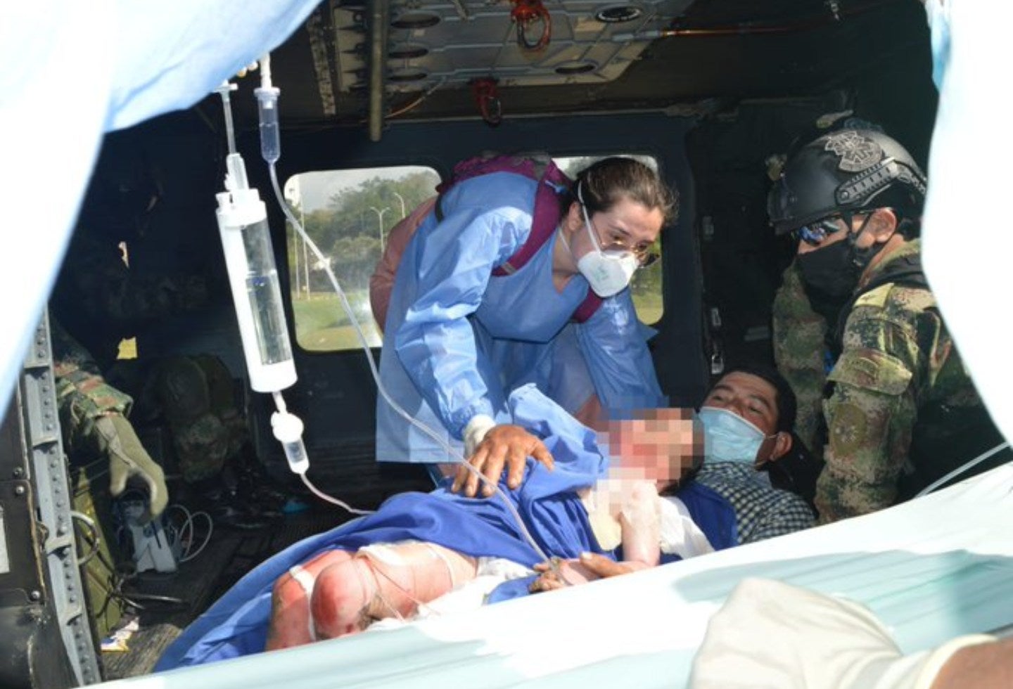 Niño quemado en Santander