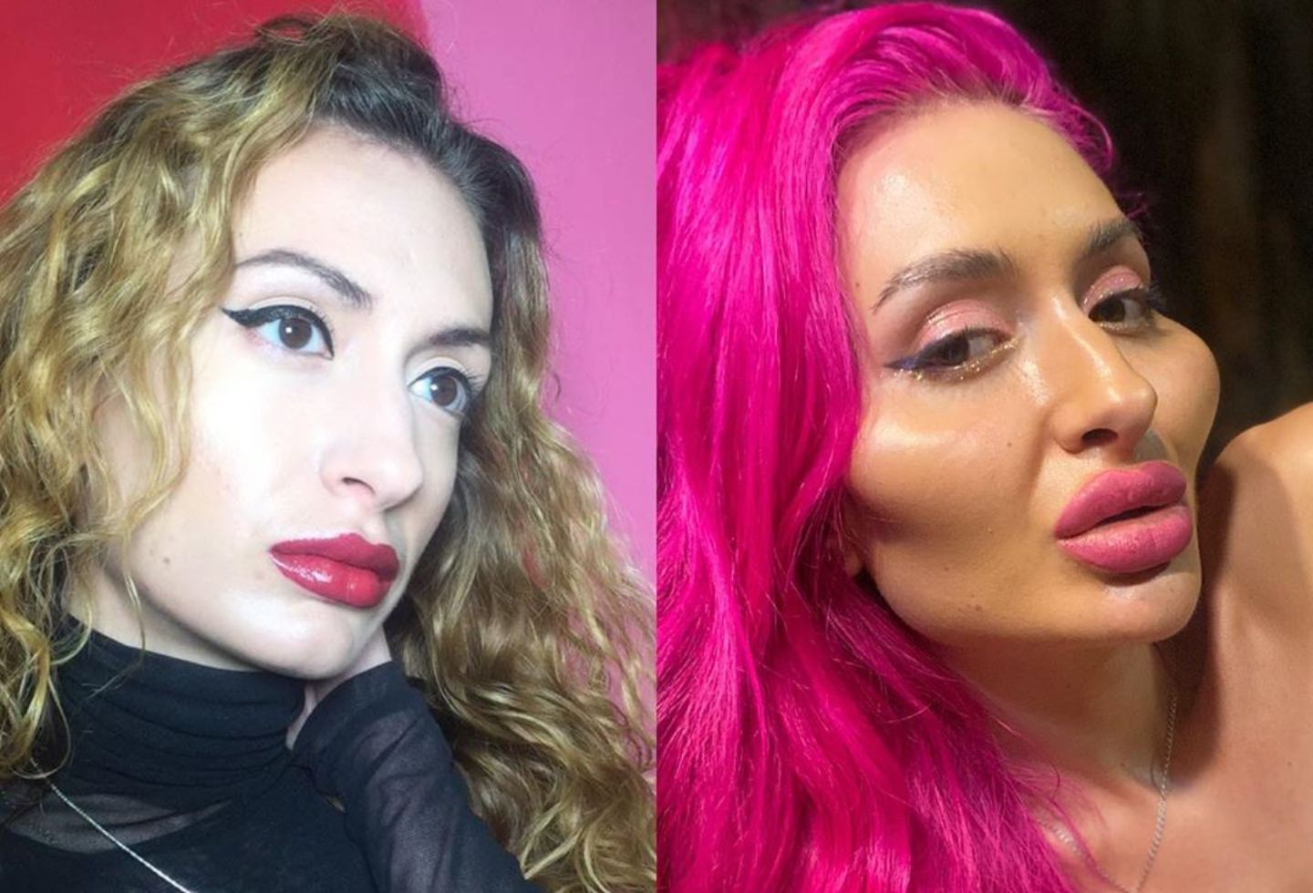 Imágenes] Mujer con las mejillas más grandes del mundo y su | La FM