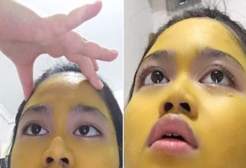 Joven se aplicó mascarilla de curcumá pero no le fue como esperaba