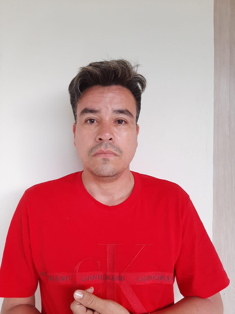 El hombre acudía a las cirugías plásticas, para evadir a las autoridades