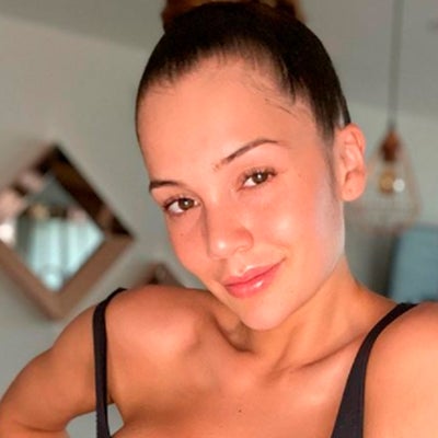 Lina Tejeiro luce y expresa el amor por sus cicatrices con sensual foto