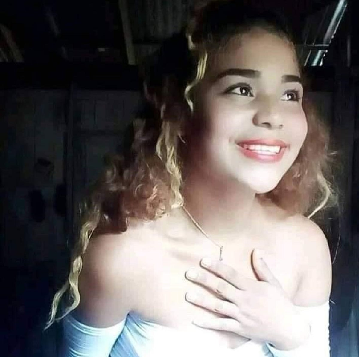 El cuerpo de la menor quedó con quemaduras de segundo y tercer grado