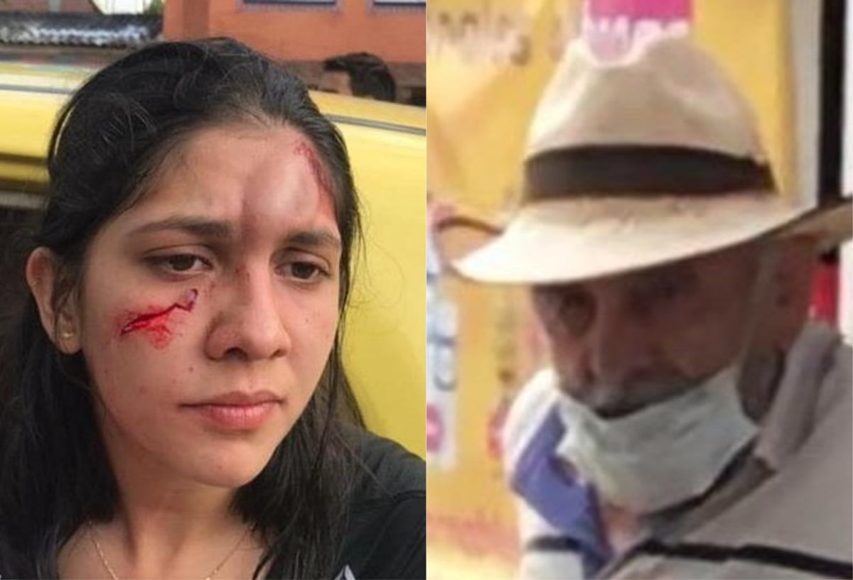 Mujer agredida
