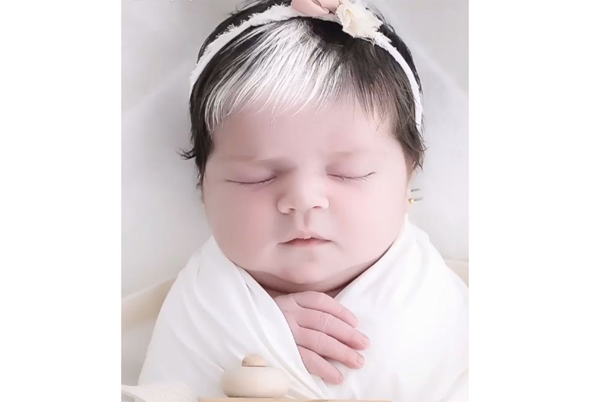 Niña con canas por extraña condición genética