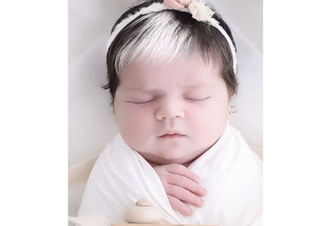 Niña con canas por extraña condición genética